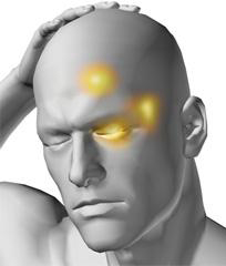 klaster glavobolja simptomi