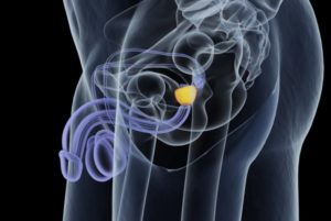 Krónikus urethritisből származó krónikus prosztatagyulladás