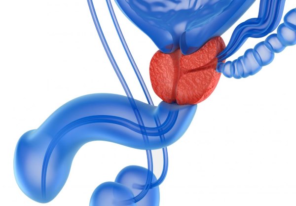 kako izleciti hronicni prostatitis