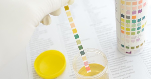 poviseni leukociti u urinu