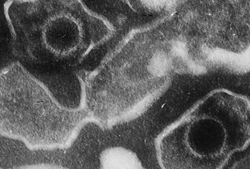 Epštajn-Barov virus