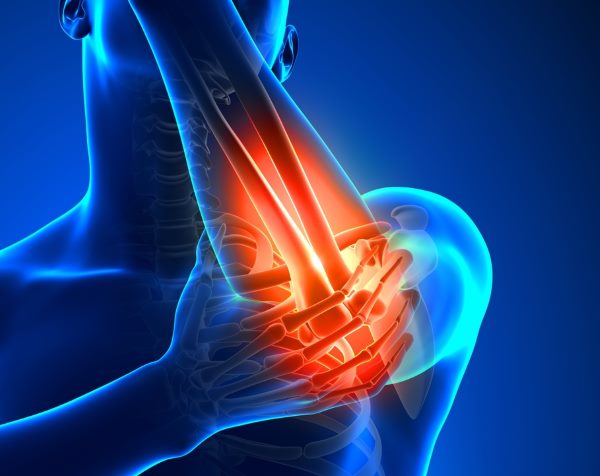 simptomi boli u zglobu kuka liječenje artroze koljena s alflutopom
